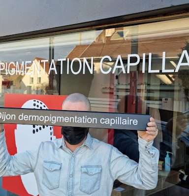 La dermopigmentation capillaire pour masquer votre perte de cheveux : calvitie