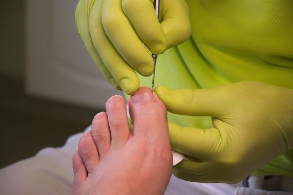 découvrez nos conseils essentiels pour prendre soin de vos pieds. apprenez des astuces pratiques pour garder vos pieds en bonne santé et prévenir les problèmes courants. explorez notre guide sur les soins des pieds pour un confort optimal au quotidien.