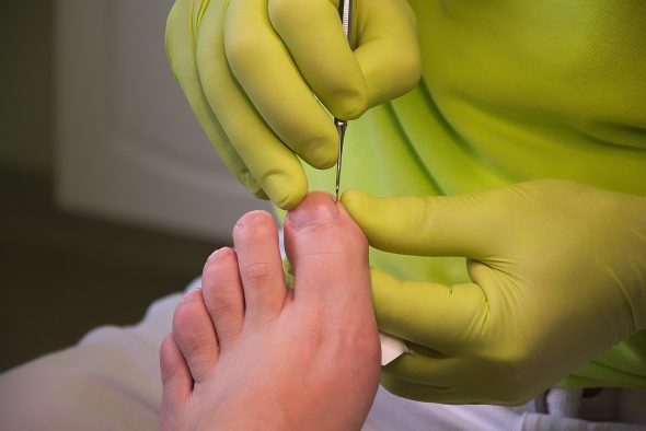 découvrez nos conseils essentiels pour prendre soin de vos pieds. apprenez des astuces pratiques pour garder vos pieds en bonne santé et prévenir les problèmes courants. explorez notre guide sur les soins des pieds pour un confort optimal au quotidien.